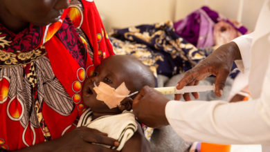 Photo of Severe malnutrition or wasting, ‘excruciatingly painful’ threat to child survival