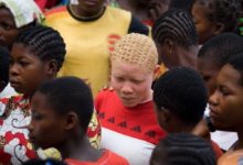 Photo of Альбинизм: трудно быть другим